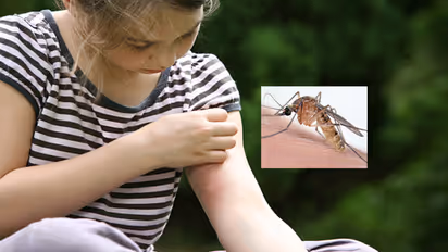 பூச்சி கடிச்சா இனி ஹாஸ்பிடலுக்கு ஓடாதீங்க! இந்த 5 எண்ணெய் உங்களுக்கு உதவும்!