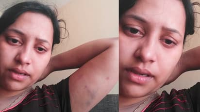 భార్యపై కృష్ణా జిల్లా టిడిపి యూత్ లీడర్ దాష్టికం