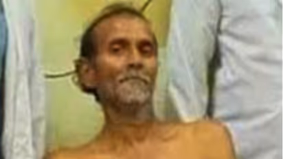 రోగి కడుపు నుండి స్టీల్ గ్లాస్ వెలికి తీసిన వైద్యులు