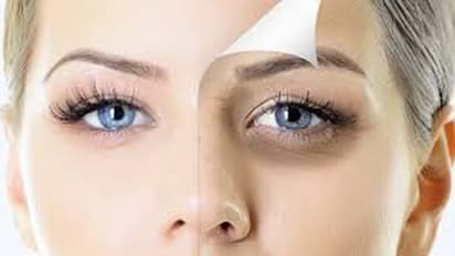 চোখের তলায় কালি পড়েছে! রোজ খান এই ৪টি ফল