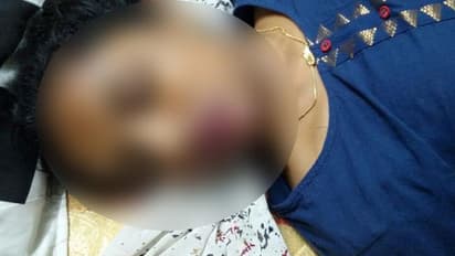 తల్లిదండ్రులపై కోపంతో యువతి ఆత్మహత్య