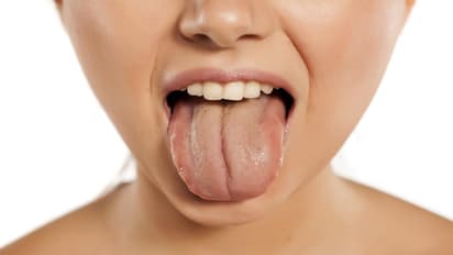 সাবধান, জিভের এই রং বলে দেবে শরীরে বাসা বেঁধেছে জটিল রোগ