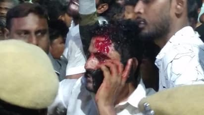 डीएमके प्रमुख करुणानिधि के स्‍वास्‍थ्‍य में सुधार, भीड़ हटाने के लिए पुलिस को करना पड़ा लाठी चार्ज