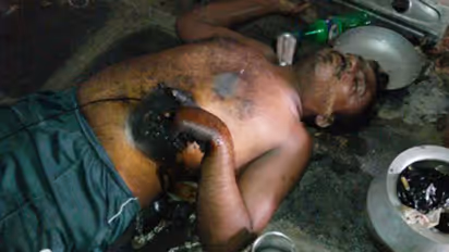 సెల్ ఫోన్ పేలి వికలాంగుడి మృతి