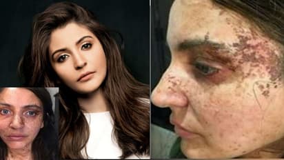 In pictures: Anushka Sharma’s ‘Pari-fect’ scary looks go viral 5 months after movie's release