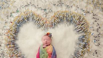 1616 ಸಿರಿಂಜ್ ಬಳಸಿ ಹುಟ್ಟಿದ 'ಮಿರಾಕಲ್ ಬೇಬಿ' ಪೋಟೊ ವೈರಲ್