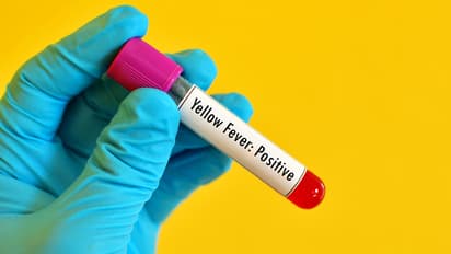 ಕೋವಿಡ್ ಬೆನ್ನಲ್ಲೇ ಹಳದಿ ಜ್ವರದ ಭೀತಿ, ಲಸಿಕೆ ಕಡ್ಡಾಯಗೊಳಿಸಿದ ಕೇಂದ್ರ ಆರೋಗ್ಯ ಇಲಾಖೆ