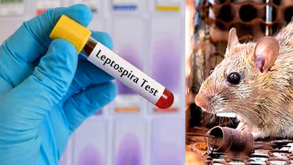 எலி காய்ச்சலால் பாதிக்கப்பட்ட குழந்தைக்கு வெறிநாய் கடிக்கான சிகிச்சை? பெற்றோர் பரபரப்பு குற்றச்சாட்டு