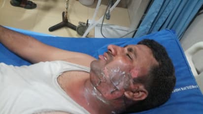 సుమన్పై హత్యాయత్నం: ఏసీపీ, శవరాజకీయాలన్న ఓదేలు