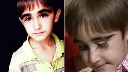 രണ്ടിഞ്ച് നീളമുള്ള കണ്പീലികളുമായി പതിനൊന്നുകാരന്...