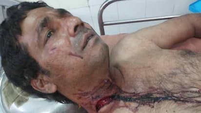 సీఎం కేసీఆర్‌కి ఫిర్యాదు చేద్దామని వచ్చి.. ఆటోడ్రైవర్ ఆత్మహత్యాయత్నం