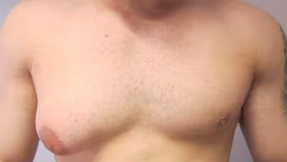 ಹುಡುಗರಲ್ಲಿ ಸ್ತನದ ಗಾತ್ರ ಹೆಚ್ಚಾಗಲು ಕಾರಣವೇನು?