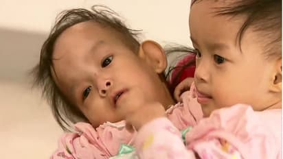 വേദനയുടെ 14 മാസങ്ങള്‍ക്കൊടുവില്‍ അവര്‍ വേര്‍പിരിയാനൊരുങ്ങുകയാണ്...