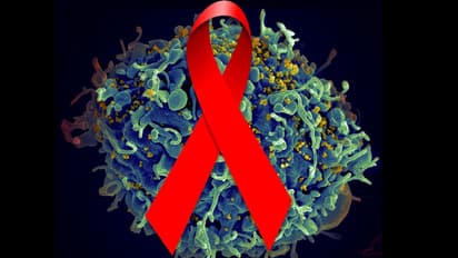 എയ്ഡ്സ് സ്ഥിരീകരിച്ചാൽ വിദേശികളെ നാടുകടത്താന് സൗദി