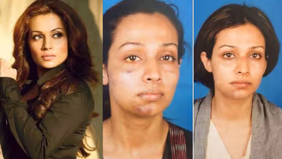 ఆ నిర్మాత దారుణంగా హింసించాడు.. నటి ఫోటోలు వైరల్!