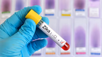 സംസ്ഥാനത്ത് മൂന്ന് പേർക്ക് കൂടി സിക്ക വൈറസ്; ഇത് വരെ രോഗം സ്ഥിരീകരിച്ചത് 51 പേർക്ക്