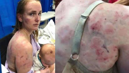 മകളുടെ ജീവന് രക്ഷിക്കാന് മുറിവുകളേറ്റു വാങ്ങിയ അമ്മ