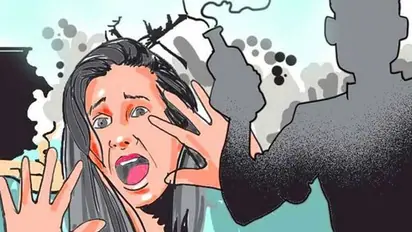 Government Stanley Medical College offer free hair transplant for acid attack