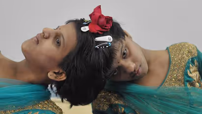 telangana inter results 2022: అవిభక్త కవలలు వీణా- వాణీలకు ఫస్ట్ క్లాస్