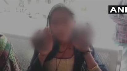 മരുമകള് വ്യഭിചാരം ചെയ്യുന്നുവെന്ന് സംശയം; അമ്മയിയമ്മ മരുമകളെ 'അഗ്നി പരീക്ഷ'ക്കിരയാക്കി