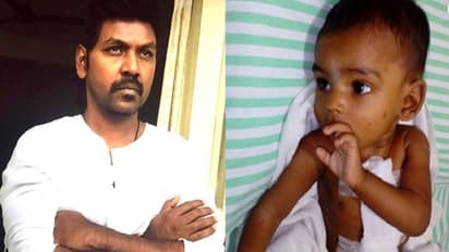 లారెన్స్ అసలైన హీరో.. 150వ సర్జరీ సక్సెస్!