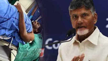 జగన్ పై దాడి.. చంద్రబాబుకి షాకిచ్చిన సొంత పార్టీ నేత