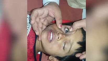 దీపావళి సంబరాలు: 50 మంది కళ్లకు గాయాలు