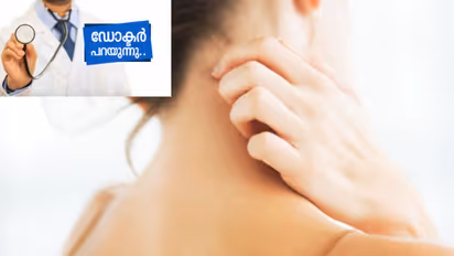 സോറിയാസിസ് പകരുമോ? അറിയേണ്ടതും മനസ്സിലാക്കേണ്ടതും...