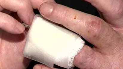 రోడ్డు మీద గొడవ... వ్యక్తి వేలు కొరికి నమిలేసిన యువకుడు