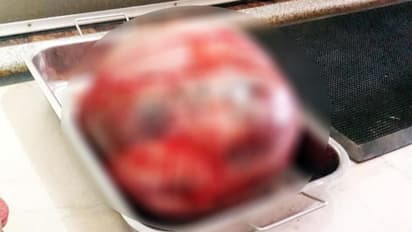 ಮಹಿಳೆಯ ಹೊಟ್ಟೆಯಲ್ಲಿ 12 ಕೆಜಿ ಗಡ್ಡೆ!