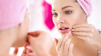 മുഖക്കുരു മാറാൻ സഹായിക്കുന്ന രണ്ട് ഫേസ് പാക്കുകൾ