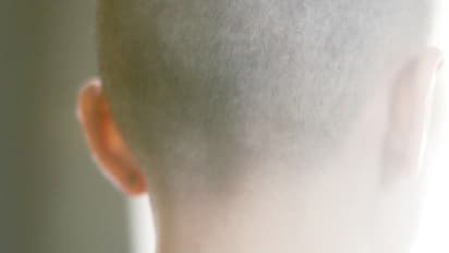 ಊಟದಲ್ಲಿ ಕೂದಲು ಸಿಕ್ಕಿತ್ತೆಂದು ಪತ್ನಿಯನ್ನು ಥಳಿಸಿ ತಲೆಬೋಳಿಸಿದ ಸೈಕೋ ಪತಿ!