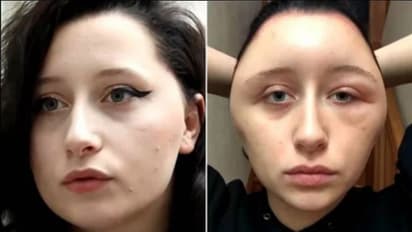 ഒന്ന് ഹെയര് ഡൈ ചെയ്തതാണ്; ഇതായി അവസ്ഥ