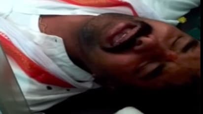 కల్వకుర్తి కాంగ్రెస్ అభ్యర్థిపై బిజెపి నాయకుల దాడి....నిమ్స్కు తరలింపు