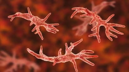 അമീബ തലച്ചോർ കാർന്ന് തിന്നു; യുവതിക്ക് ദാരുണാന്ത്യം