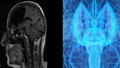 ചൈനയില് പുതിയ ബ്രെയിന് സ്കാനര്; ആത്മാവുകളെ കുറിച്ച് കൃത്യമായി വിവരം നല്കുമോ?