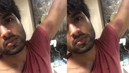 విజయ్ దేవరకొండ కు గాయాలు