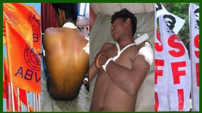 കാലടിയില് എസ്എഫ്ഐയ്ക്കാരെ കുടുക്കാന് ശരീരത്തില് ആഴത്തില് മുറിവുണ്ടാക്കിയ എബിവിപിക്കാരന് അന്വേഷണത്തില് കുടുങ്ങി