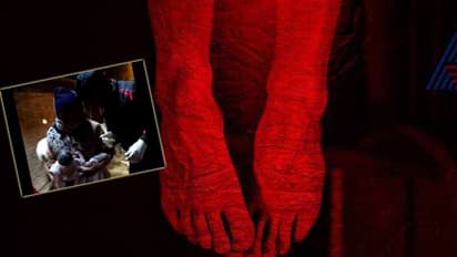 ನೇಣಿಗೇರಿ ನೇತಾಡುತ್ತಿದ್ದ ತುಂಬು ಗರ್ಭಿಣಿಗೆ ಹೆರಿಗೆ!