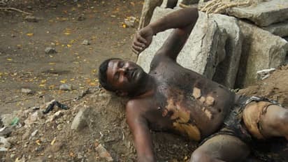 நடுரோட்டில் தீக்குளித்த காவலாளி… மயிலாப்பூரில் பரபரப்பு...!