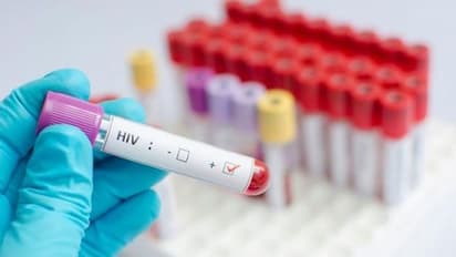HIV ಸೋಂಕಿಗೆ ಸಿಕ್ತು ಔಷಧಿ?: ಏನಿದು ಲೇಸರ್ ಆರ್ಟ್?