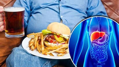 Fatty Liver: Recognize the signs and symptoms of fatty liver disease for timely treatment