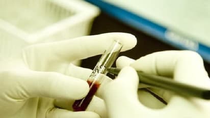 കുവൈത്തില് 42 സൈനിക ഉദ്യോഗസ്ഥര്ക്ക് എയിഡ്സ് രോഗബാധ സ്ഥിരീകരിച്ചു