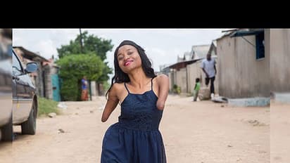 വീഡിയോ: കൈയും കാലുമില്ല, പക്ഷെ വിസ്മയിപ്പിക്കും ഈ പെണ്‍കുട്ടി