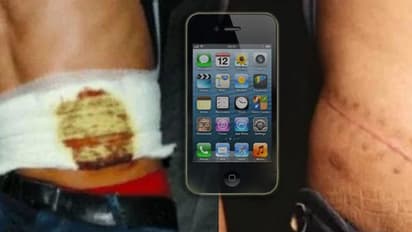 iPhone ಶೋಕಿಗಾಗಿ ಕಿಡ್ನಿಯನ್ನೇ ಮಾರಿದ ಬಾಲಕ: ಜೀವಕ್ಕೆ ಕುತ್ತು!