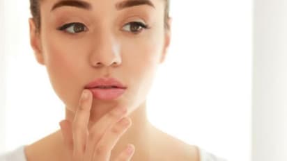 ഈ തണുപ്പ് കാലത്ത് ചുണ്ടുകൾ വരണ്ട് പൊട്ടുന്നത് തടയാൻ ചെയ്യേണ്ടത്...