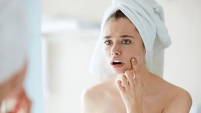 ಹೆಂಗಳೆಯರೇ ಕೇಳಿ.. ಮುಖದ ಮೇಲಿನ ಕಪ್ಪು ಕಲೆಗೆ ಮೊಬೈಲ್, ಕಂಪ್ಯೂಟರ್ ಕಾರಣವಂತೆ!