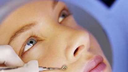 ബ്ലാക്ക് ഹെഡ്സ് അകറ്റാൻ ഇതാ 3 എളുപ്പ വഴികൾ...