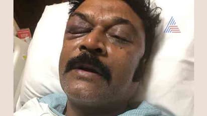 ಏಟು ತಿಂದ ಆನಂದ್ ಸಿಂಗ್ ಹೇಗಿದ್ದಾರೆ? ಫೋಟೋ ಹಿಂದಿನ ಸತ್ಯ!