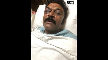 ಆಸ್ಪತ್ರೆಗೆ ಬಂದ DKS ಜತೆ ಗಲಾಟೆ ಬಗ್ಗೆ ಅರ್ಧ ಗಂಟೆ ಮಾತನಾಡಿದ ಆನಂದ್ ಸಿಂಗ್